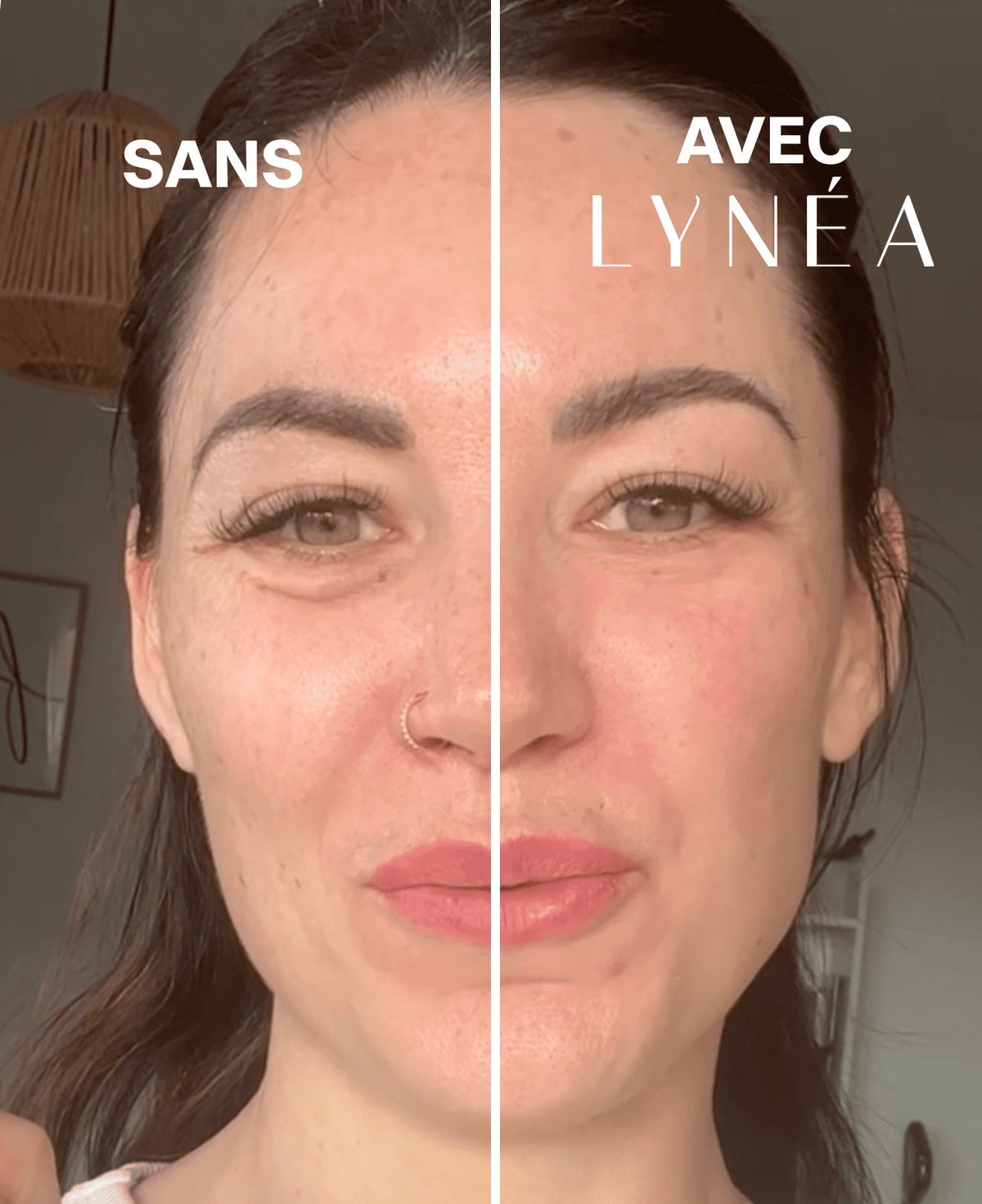 Le même visage, sans et avec le brossage LYNÉA™